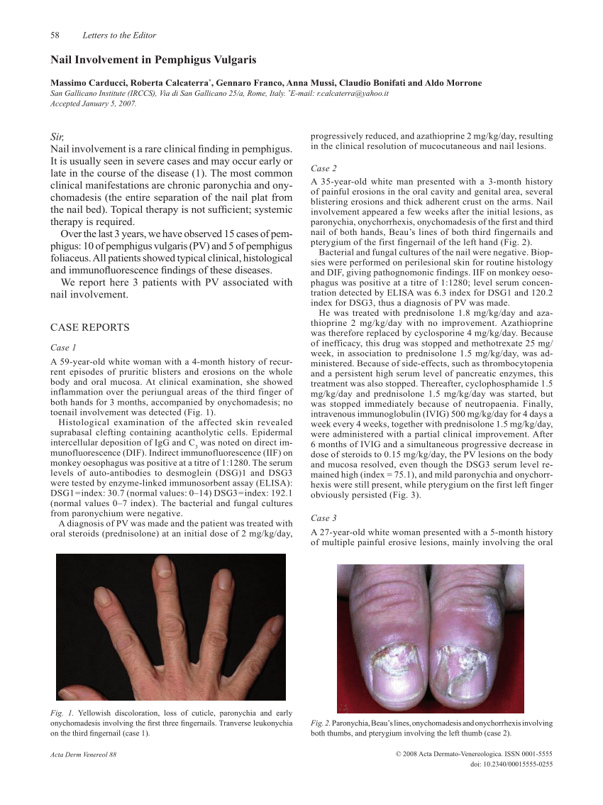 Clinical Challenge: Hair and Nail Changes - MPR