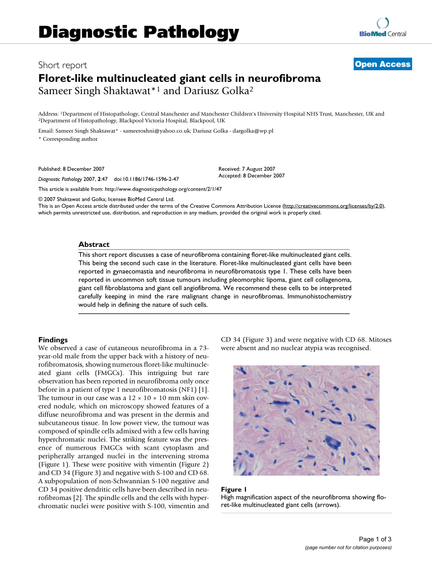 JCDR - Floret giant cells, Ropey collagen, Soft tissue neoplasm