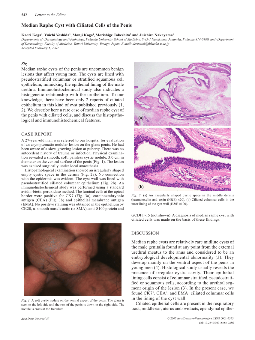 umflarea penisului și a pubisului