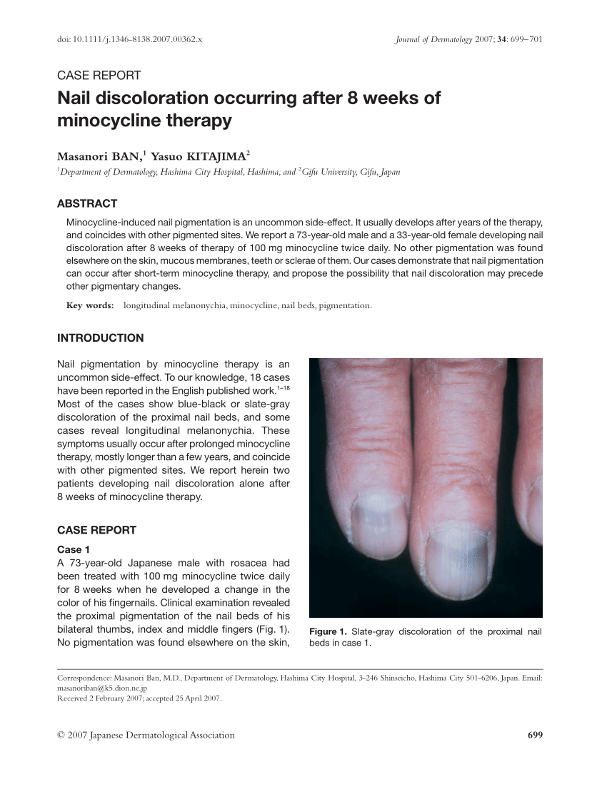 Blue, pale, or grey fingernails or lips | COVID infection | 11alive.com