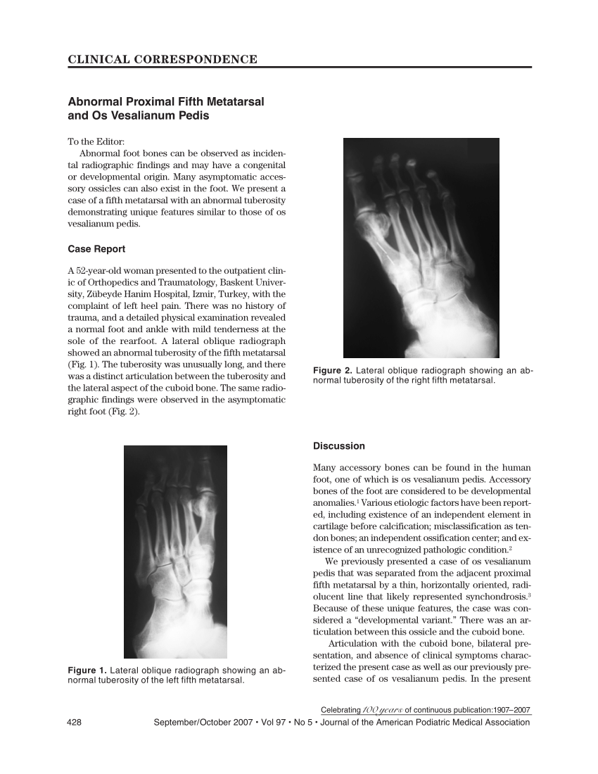 Pdf Abnormal Proximal Fifth Metatarsal And Os Vesalianum Pedis