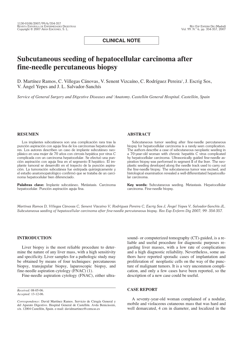 Hepatocellular Carcinoma Invasive To Chest Wall