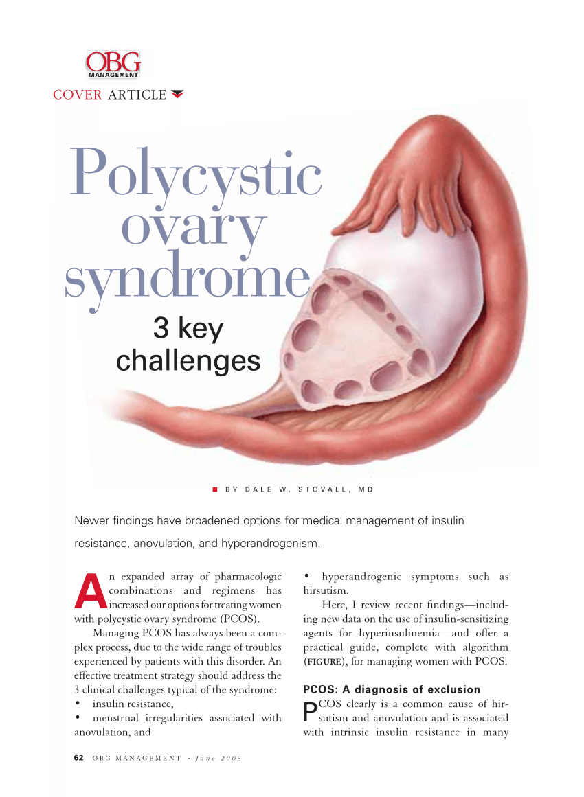Polycystic ovary syndrome patients prone to diabetes later 