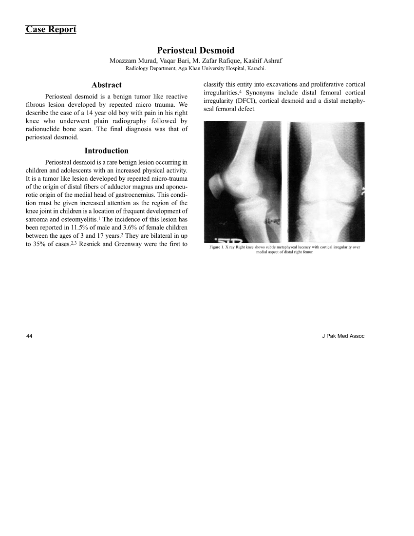 Pdf Periosteal Desmoid