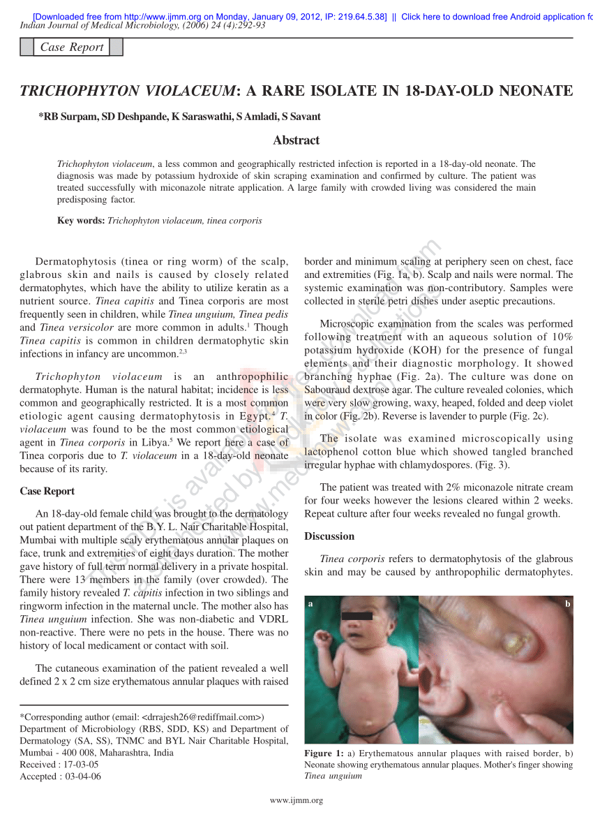 Tinea capitis in infants in their first 2 years of life: A 12-year study  and a review of the literature