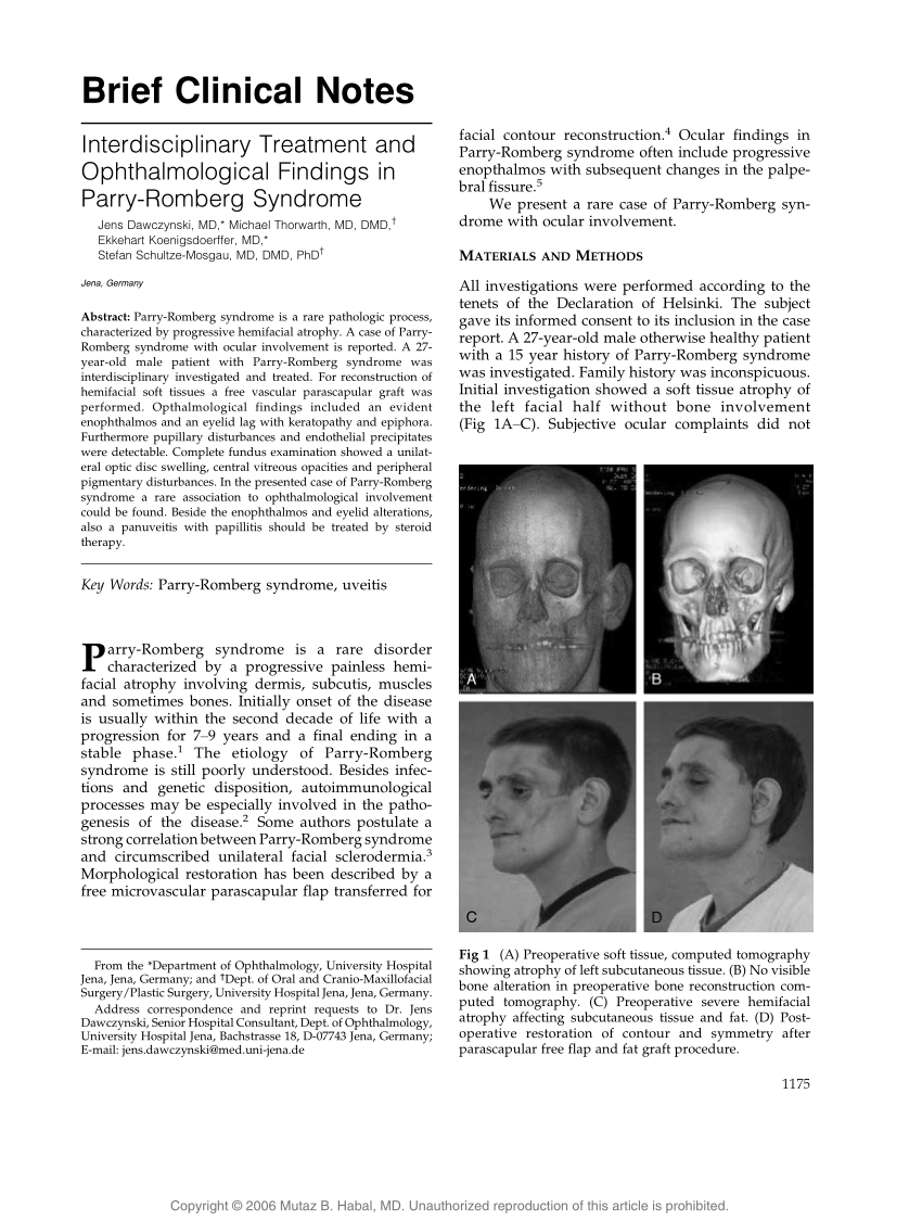 PDF) Traumatic Displacement of Teeth Into Maxillary Sinus Cavity