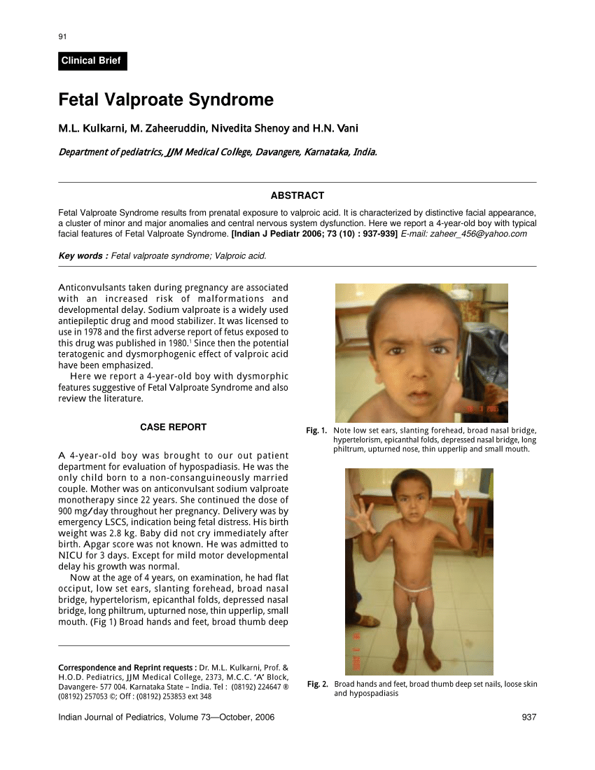 Pdf Fetal Valproate Syndrome