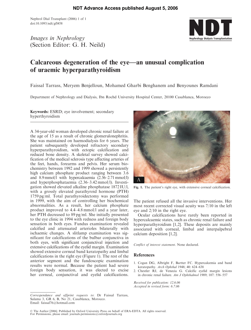 Pdf Calcareous Degeneration Of The Eye An Unusual Complication Of Uraemic Hyperparathyroidism