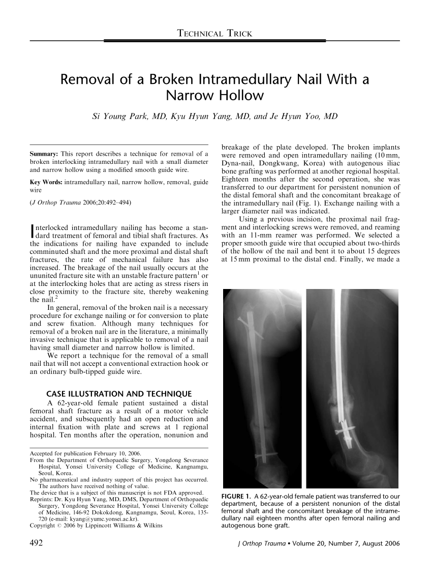 Intra-articular Retrograde Nail Insertion for Femoral Frx : Wheeless'  Textbook of Orthopaedics
