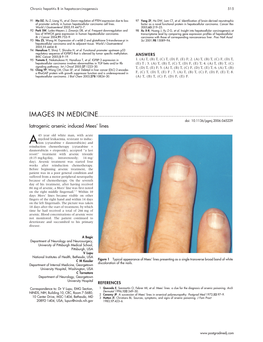 Mee ' s lines over nails | Download Scientific Diagram