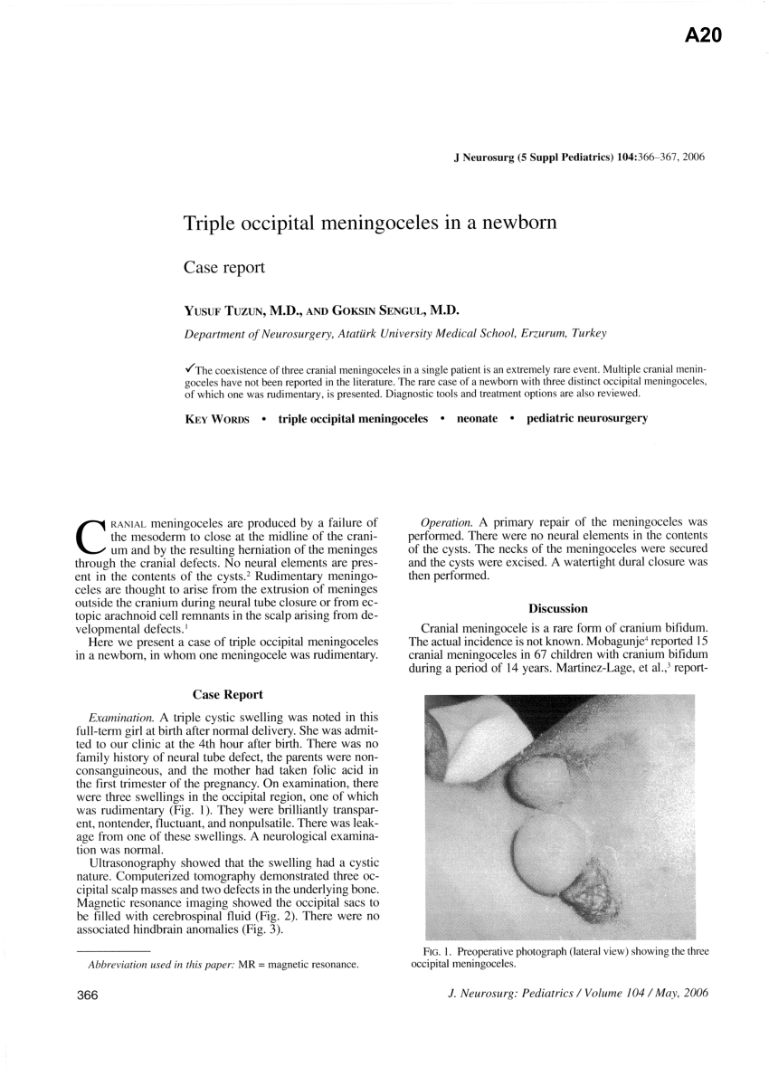 cranial meningocele