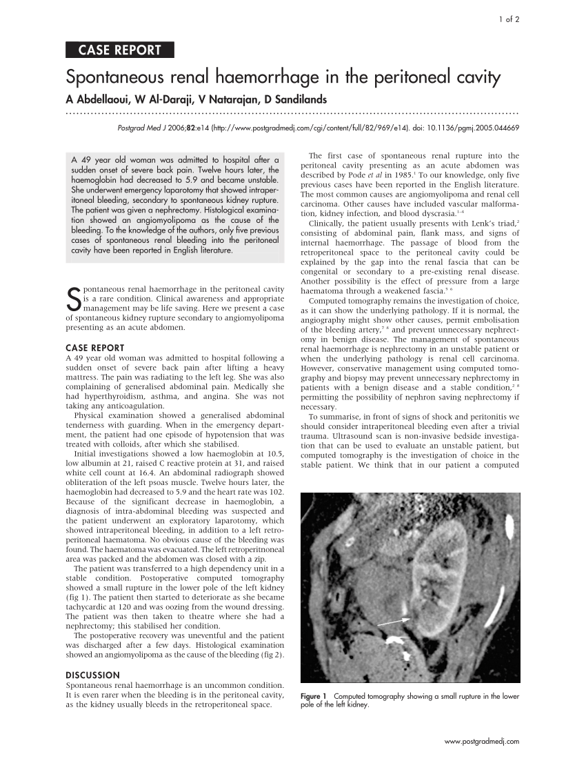 Sudden onset flank pain: a case report of retroperitoneal hemorrhage s