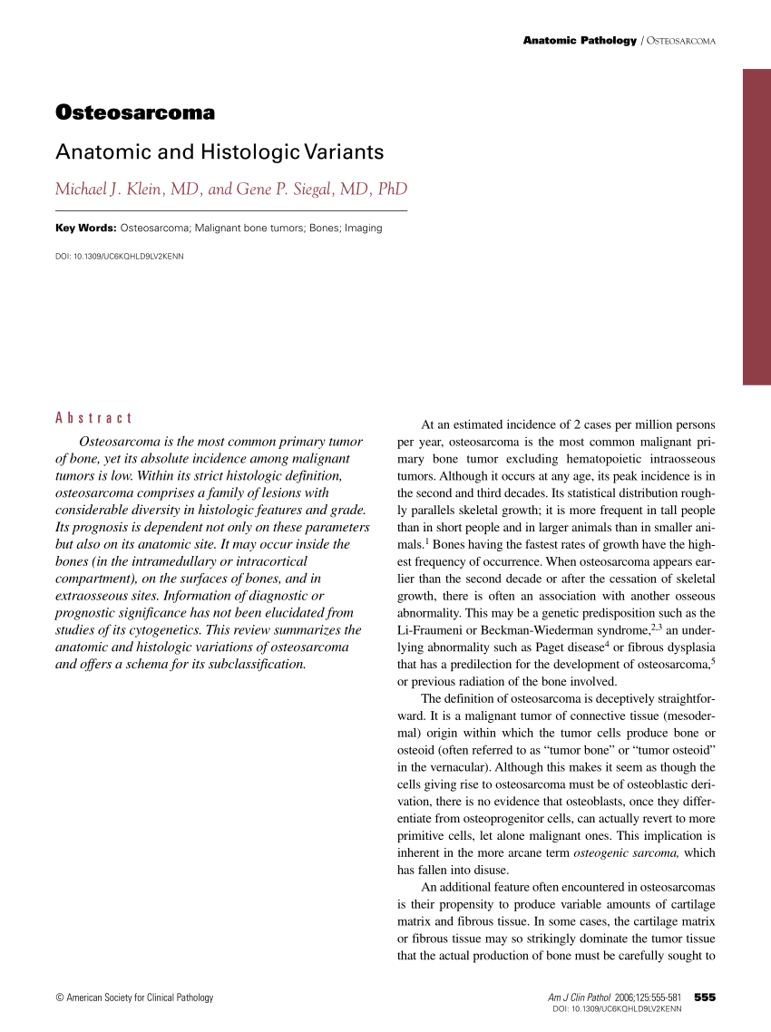 literature review osteosarcoma