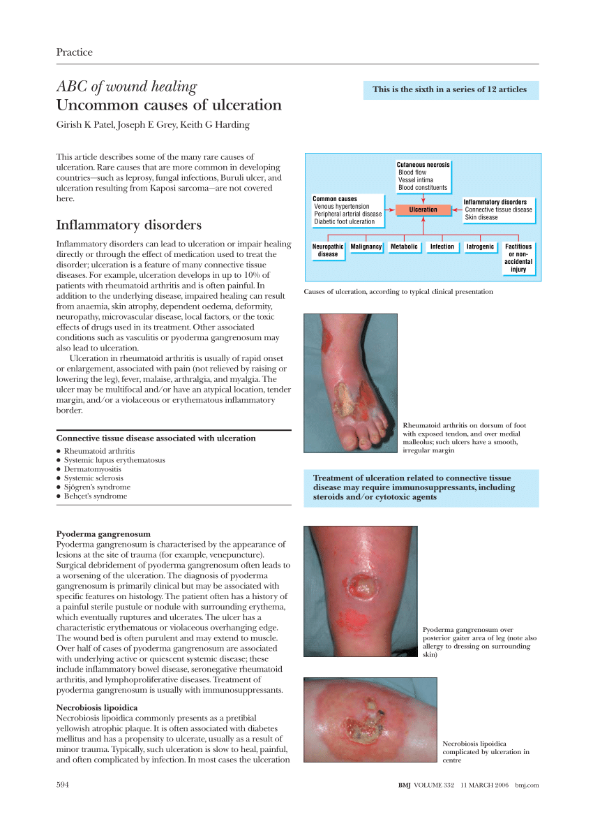 (PDF) ABC of wound healing: uncommon causes of ulceration