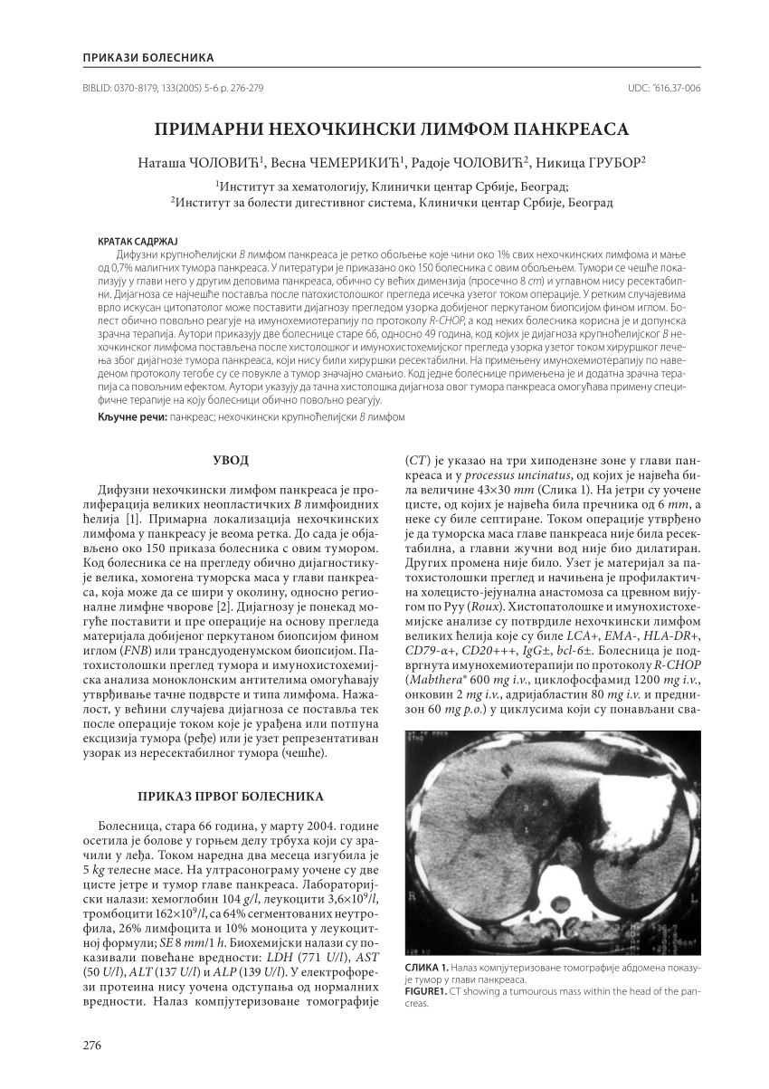 Pdf Primary Pancreatic Non Hodgkin S Lymphoma