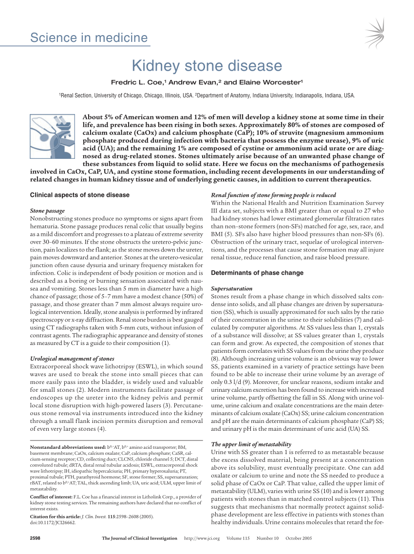 research paper on kidney stones