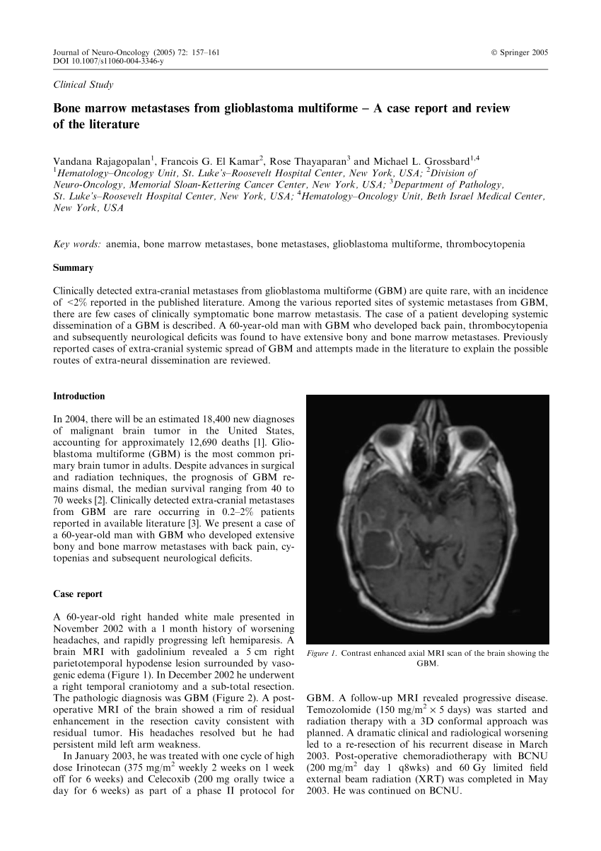 Glioblastoma Multiforme Liver Metastasis