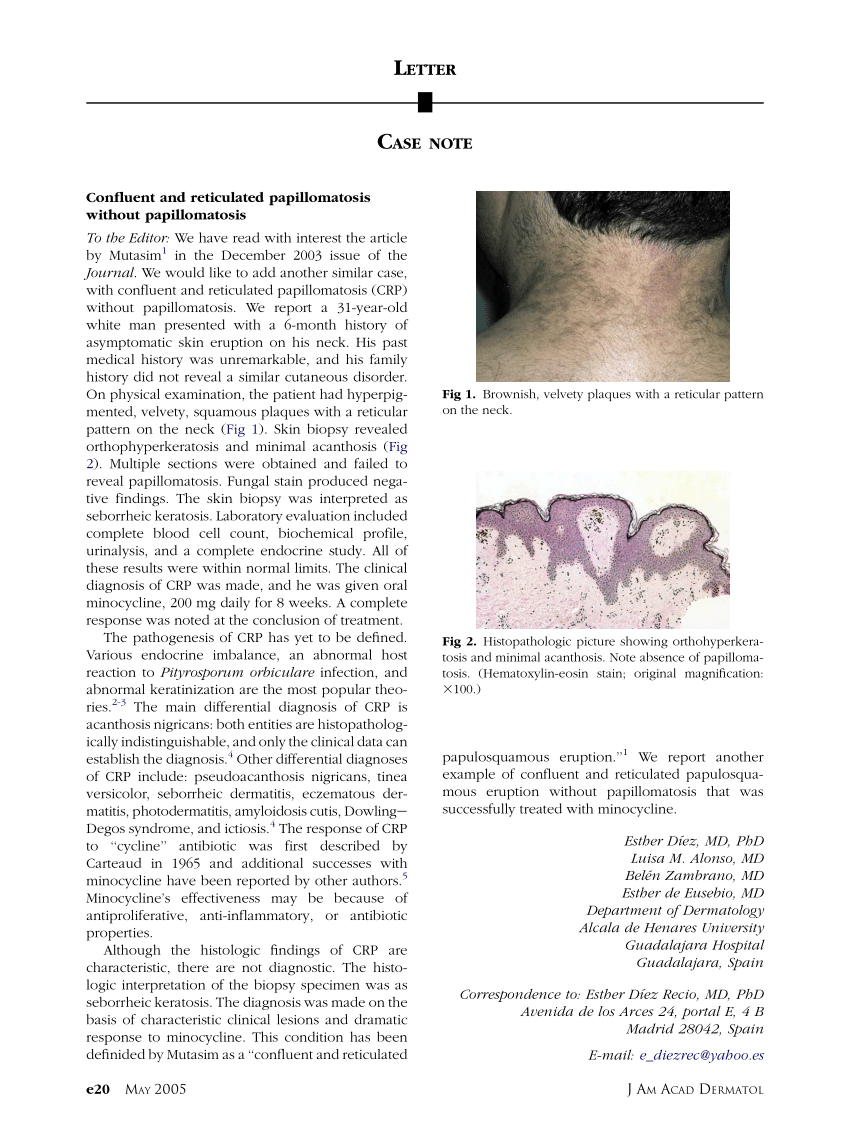 Szabálytalan papillomatosis acanthosis - A belgyógyászat alapjai 1. | Digitális Tankönyvtár
