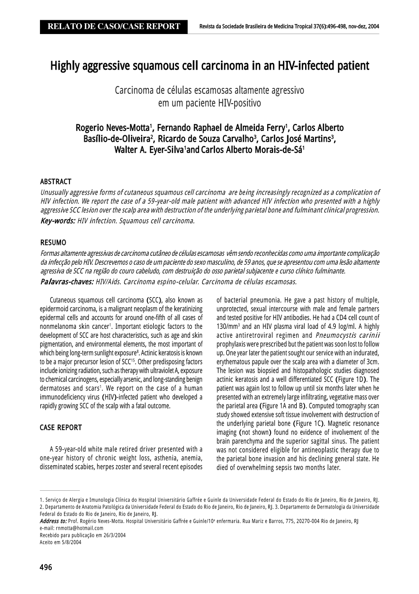 Pdf Highly Aggressive Squamous Cell Carcinoma In An Hiv Infected Patient