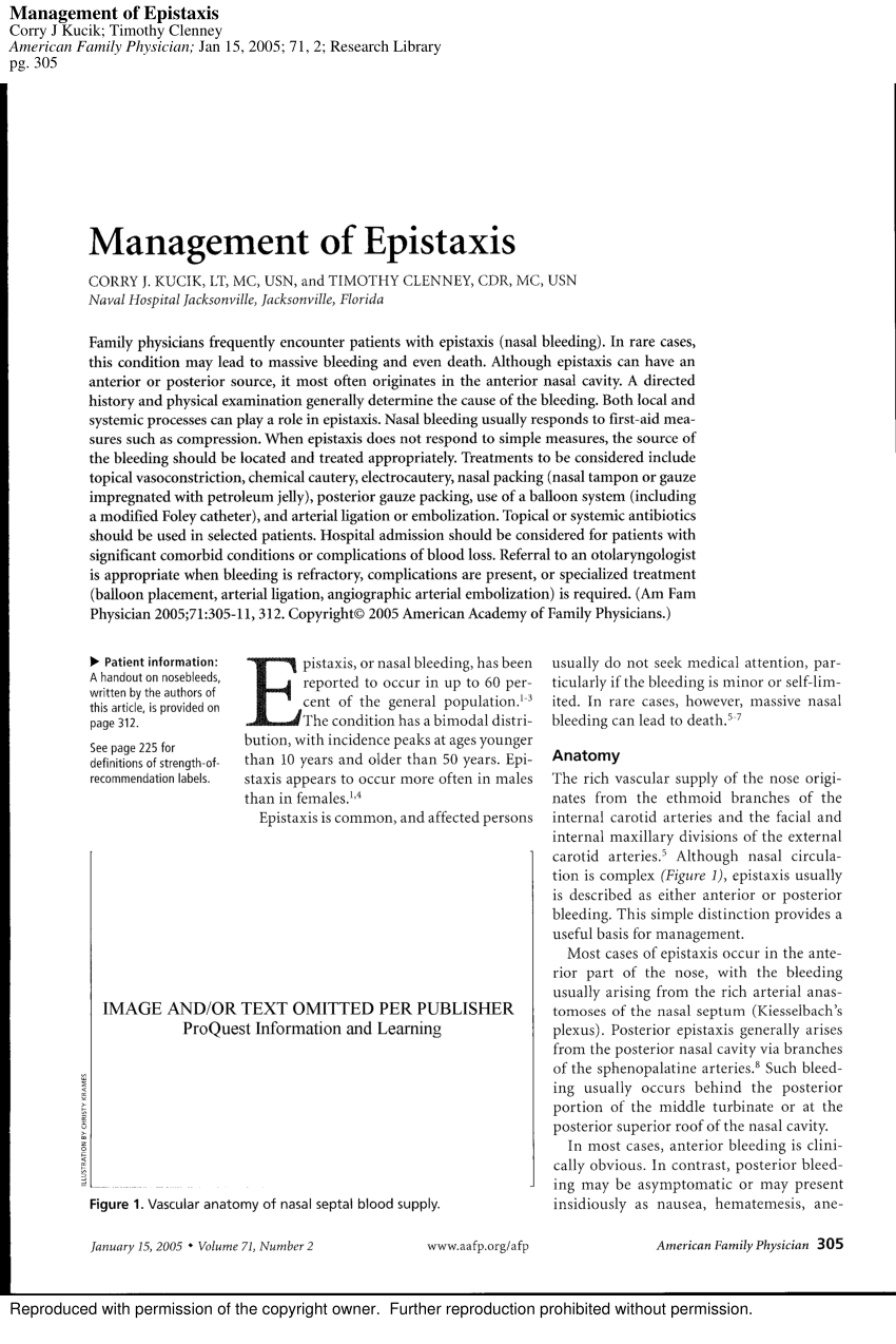 Management of epistaxis (PDF Download Available)