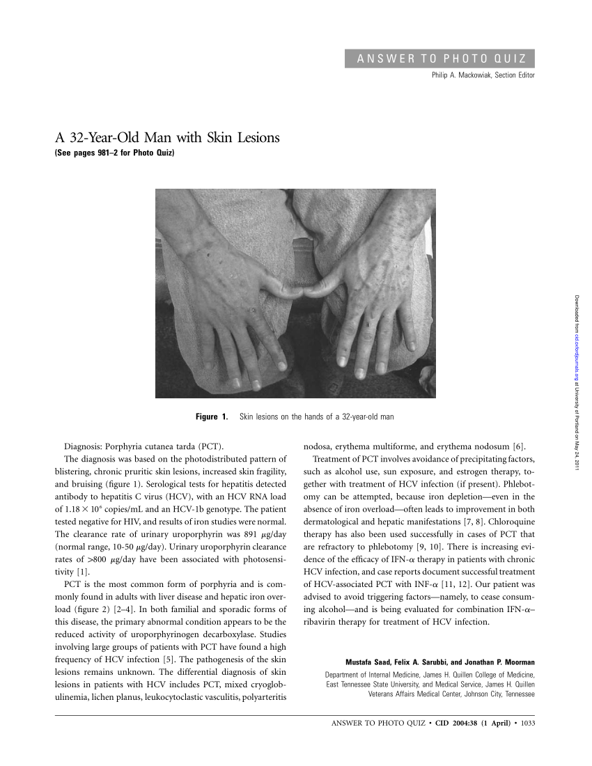 pdf-a-32-year-old-man-with-skin-lesions