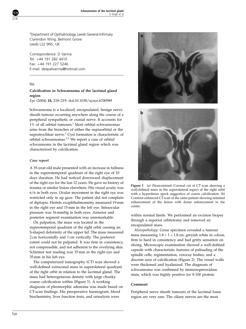 Pdf Calcification In Schwannoma Of The Lacrimal Gland Region 1815