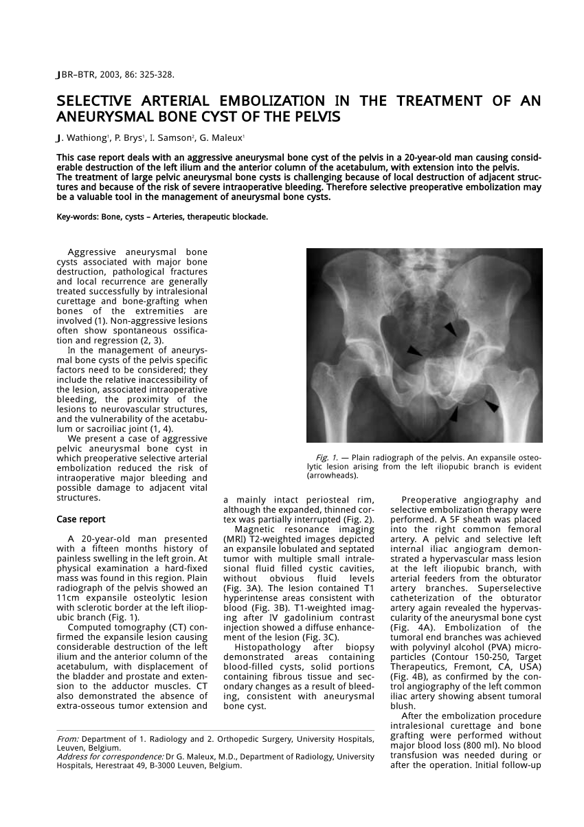 Pdf Selective Arterial Embolization In The Treatment Of An Aneurysmal Bone Cyst Of The Pelvis 1261