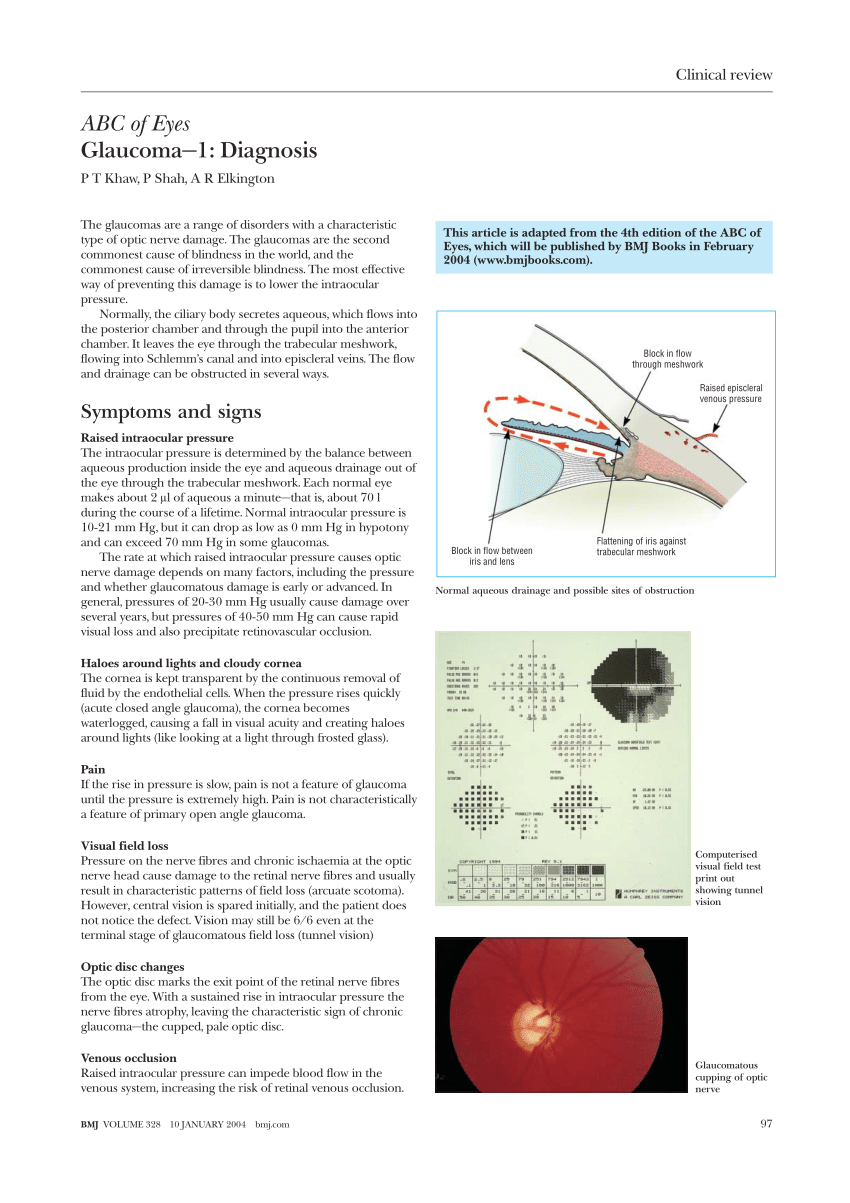 research article on glaucoma